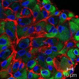 GT2 P15 (3 induced nestin 1-50)