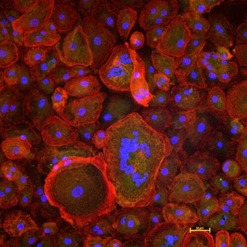 Osteoclast Image