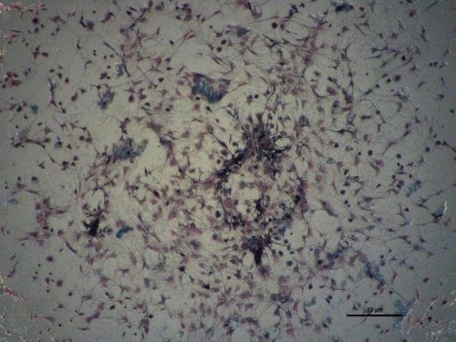 control 4x 3 with scale_bone marrow CFU (HAP paper)