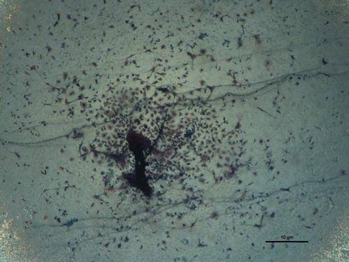 hap-pth 4x 1 with scale_bone marrow CFU_HAP-PTH (HAP paper)